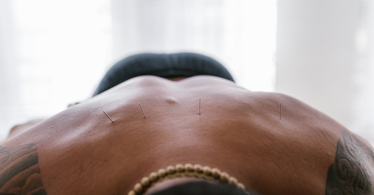 Cover Image for Revolutionary Clinical Trial Aims to Alleviate Back Pain – Discover Your Path to Relief